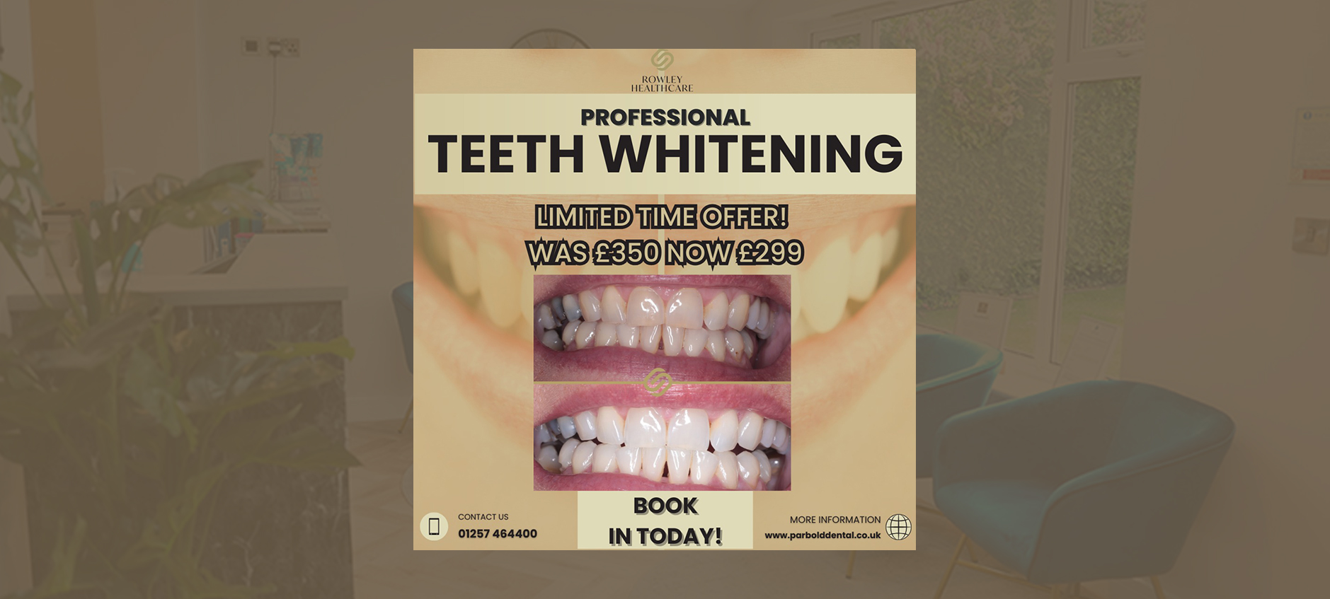 Free Smile Makeover Consultations