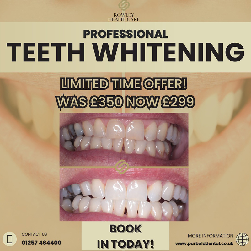 Free Smile Makeover Consultations